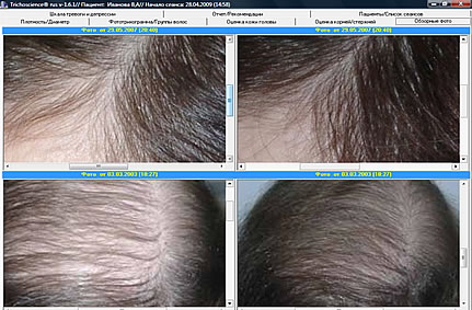Оценка обзорных фотографий волосистой части головы