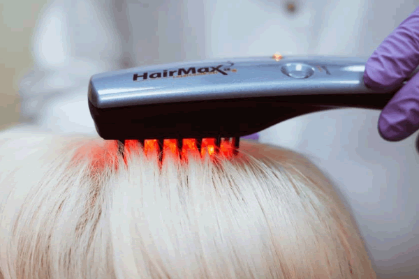 Что такое и как работает Лазерная расческа «HairMax LaserComb» 
