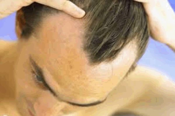Почему лечение волос у мужчин должно быть комплексным