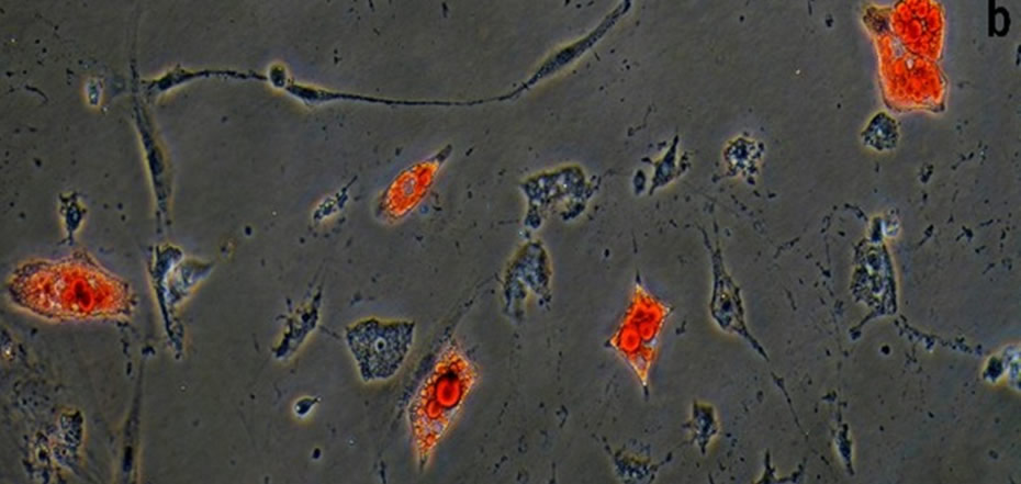 Под действием бальзама стволовые клетки мышей превращаются в жировые. Пузырьки жира окрашены красным