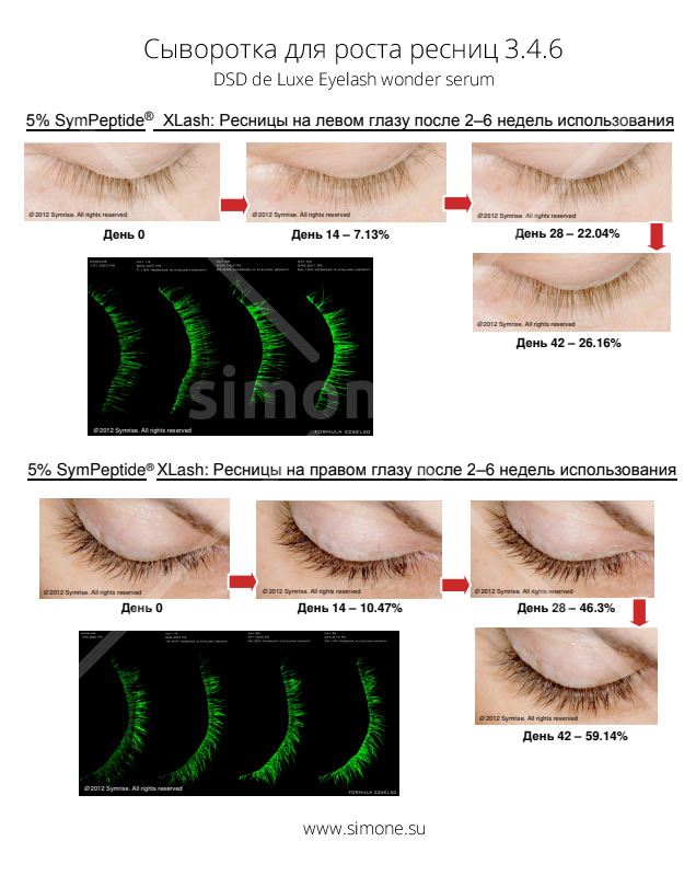 Результаты применения Сыворотка для роста ресниц 3.4.6 DSD de Luxe Eyelash wonder serum